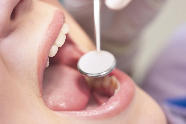 その場しのぎの治療は、歯の健康を損なうことに。