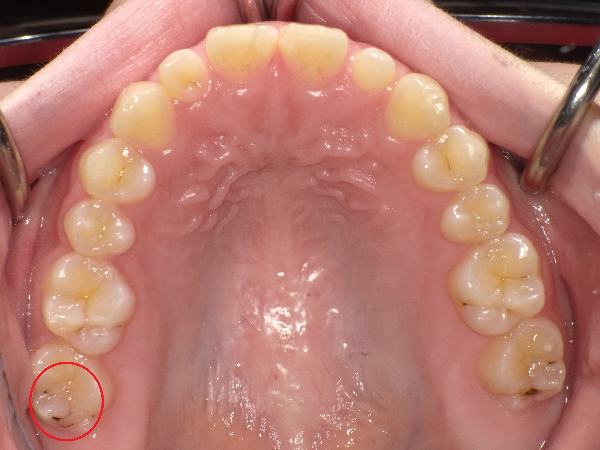 https://www.s-shika-clinic.com/asset/PICT004787.jpg