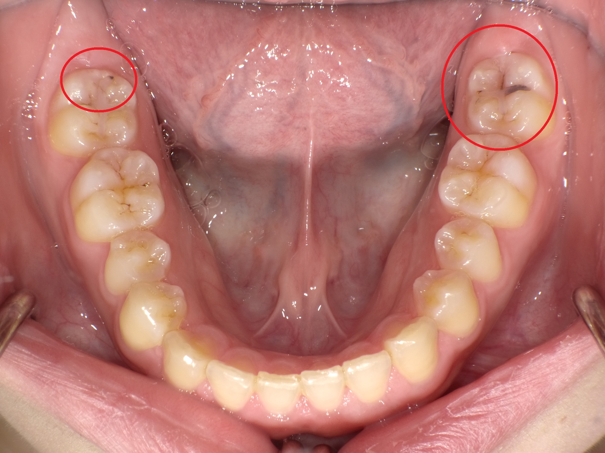 https://www.s-shika-clinic.com/asset/PICT0049.jpg
