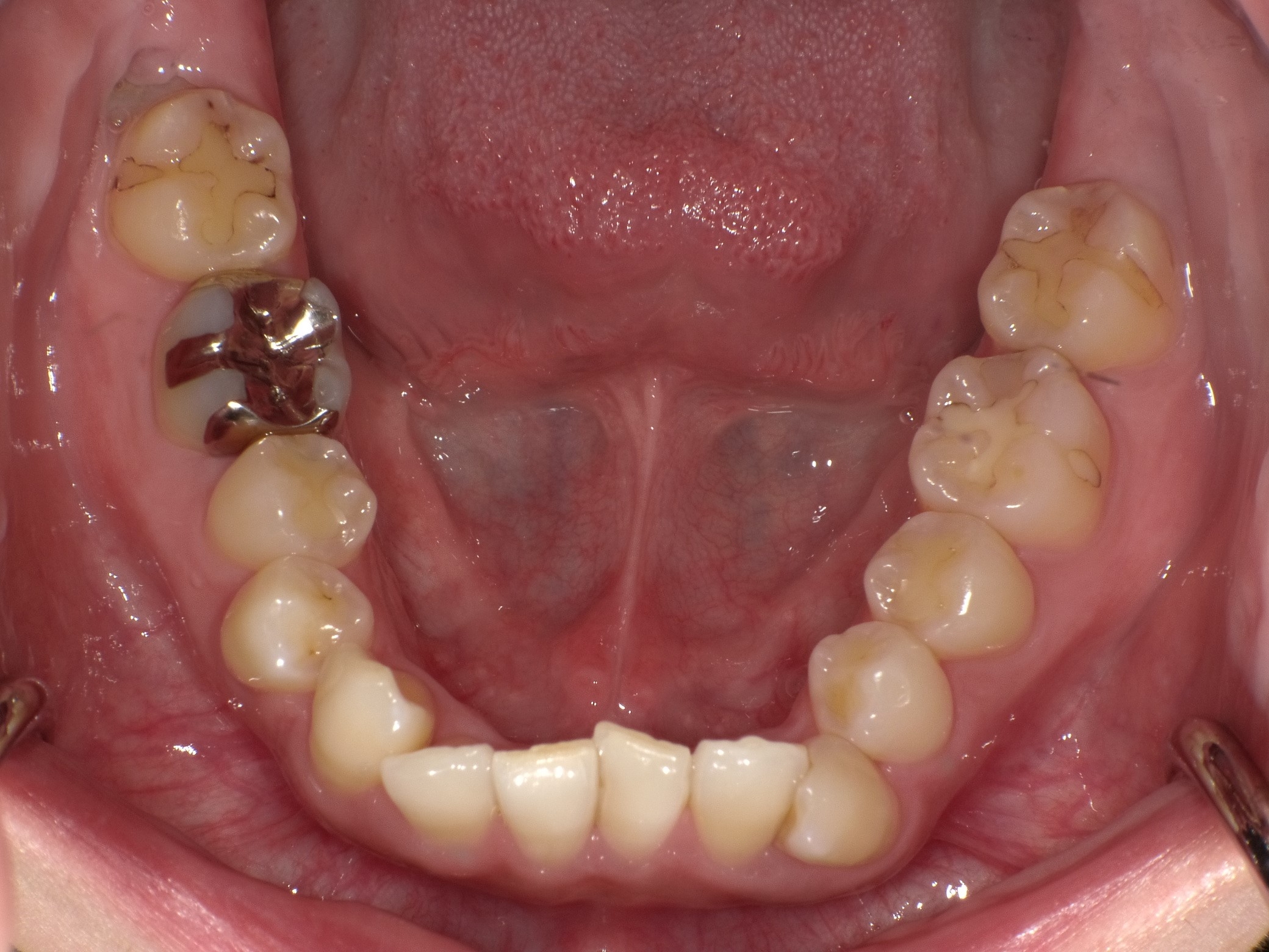 https://www.s-shika-clinic.com/asset/ffdfd.jpg