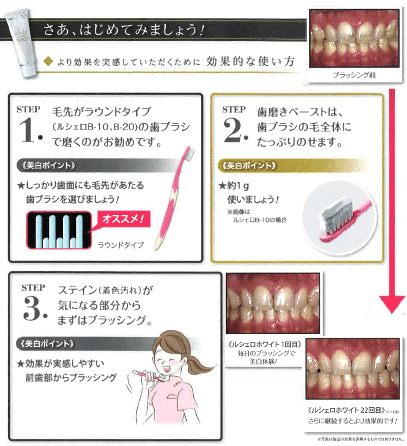 https://www.s-shika-clinic.com/asset/imgrc0065974004.gif