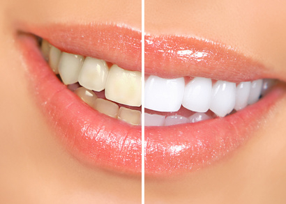https://www.s-shika-clinic.com/asset/stockfoto_23842166_S.jpg