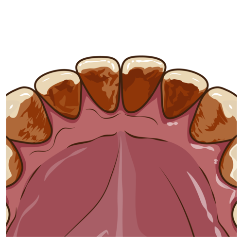 エアフローについて 画像