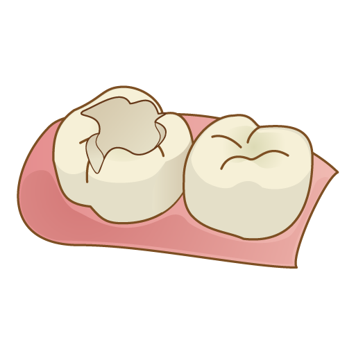 仮蓋って必要？ 画像