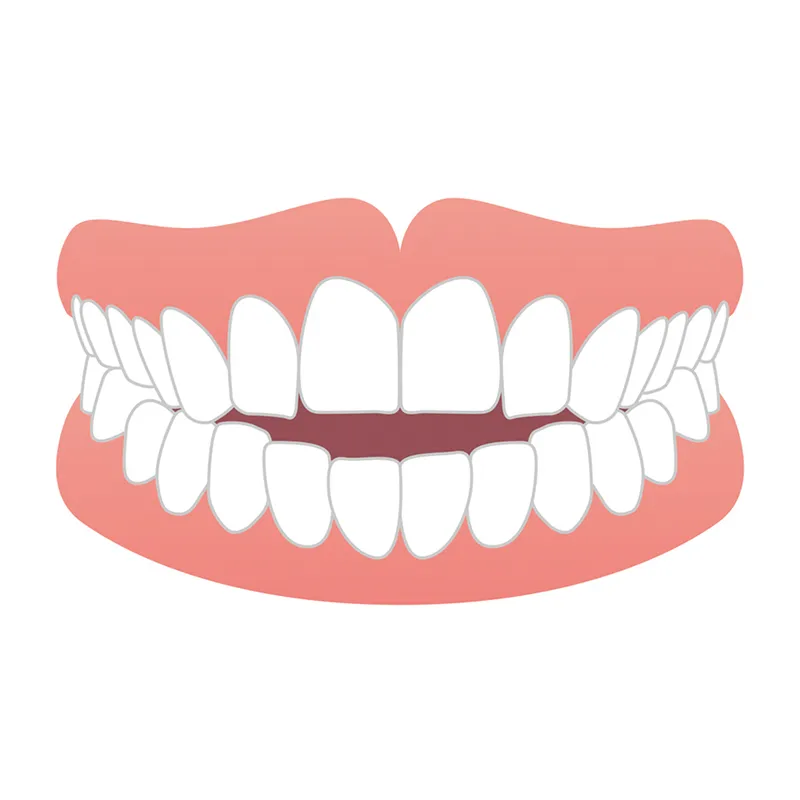 開咬（オープンバイト）