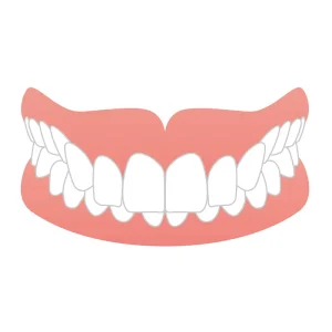 過蓋咬合（かがいこうごう）