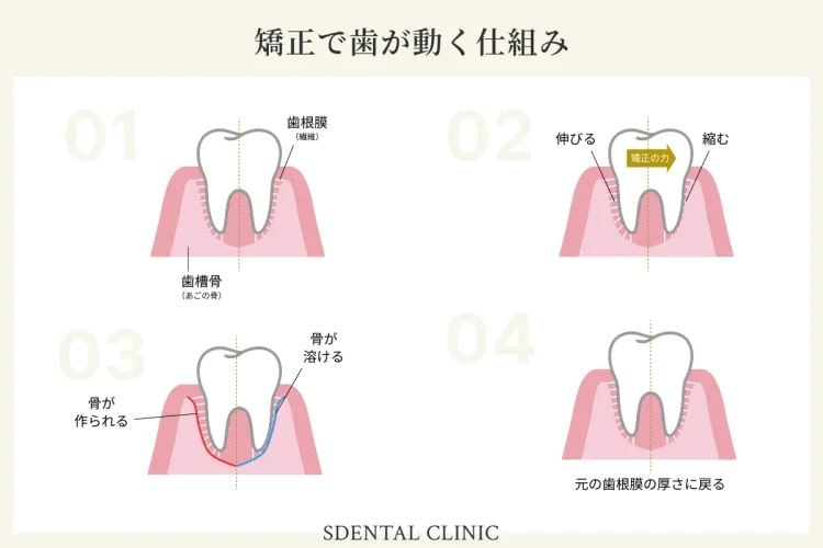 マウスピースで歯が動く仕組みの図